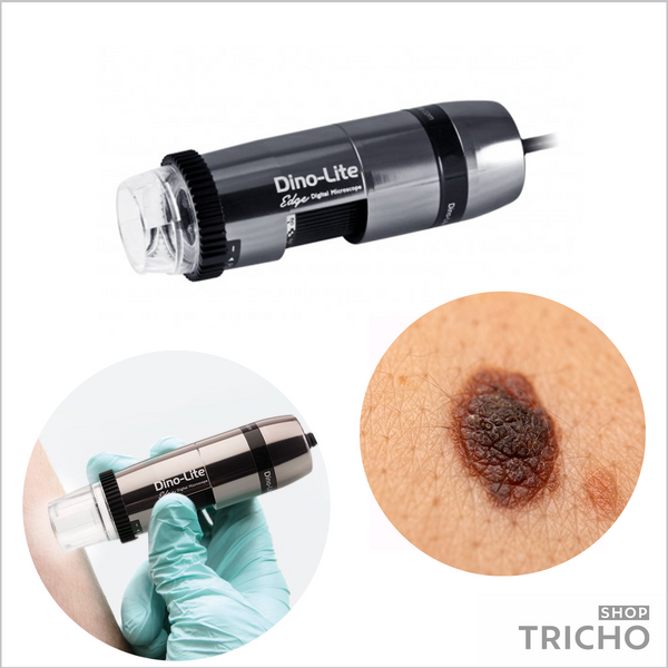 Дерматоскоп DermaScope&reg; POLARIZER HR, MEDL7DW 7004 фото
