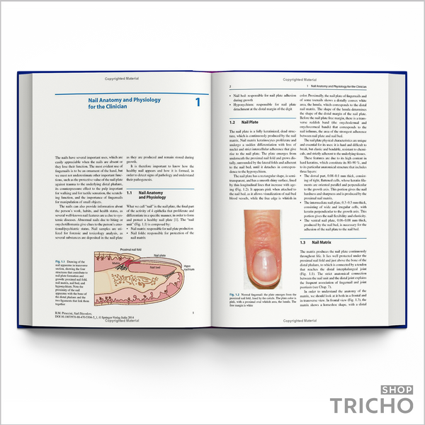 Nail Disorders. A Practical Guide to Diagnosis and Management 5004 фото