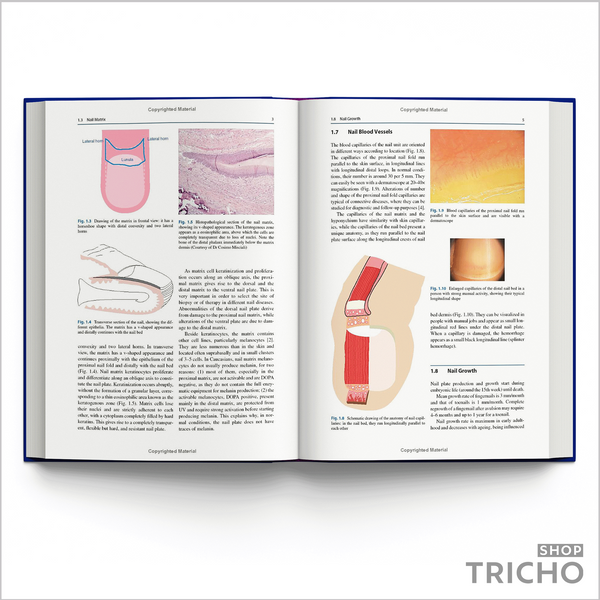 Nail Disorders. A Practical Guide to Diagnosis and Management 5004 фото