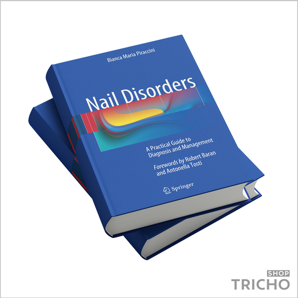 Nail Disorders. A Practical Guide to Diagnosis and Management 5004 фото