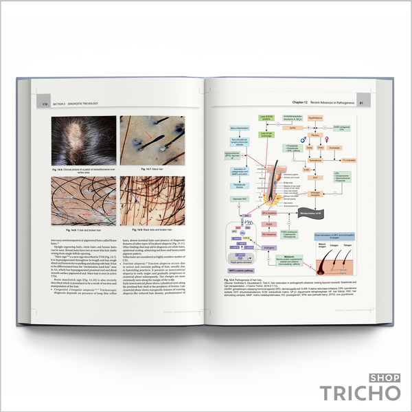 IADVL Textbook of Trichology &ndash; Современное руководство по заболеваниям волос и кожи головы 5006 фото