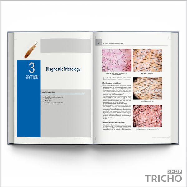 IADVL Textbook of Trichology &ndash; Современное руководство по заболеваниям волос и кожи головы 5006 фото