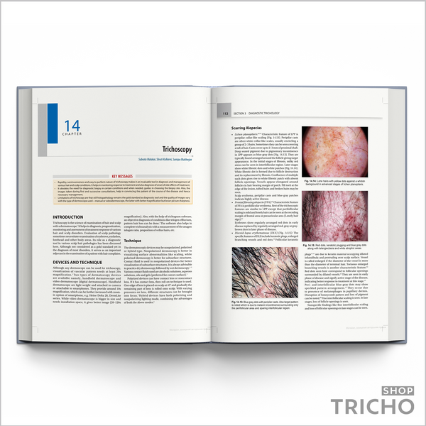 IADVL Textbook of Trichology &ndash; Современное руководство по заболеваниям волос и кожи головы 5006 фото