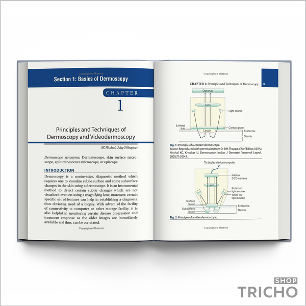 Dermoscopy, Trichoscopy and Onychoscopy in Diseases of the Pigmented Skin: An Atlas and Short Text  5007 фото