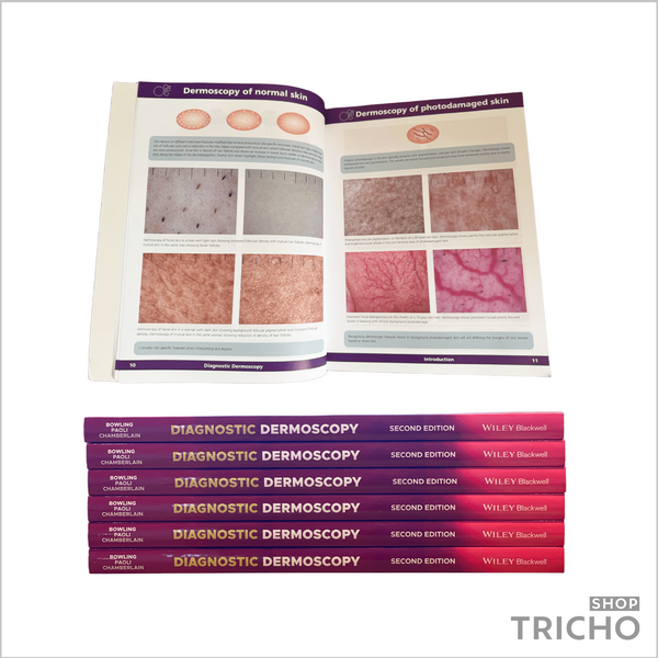 Diagnostic Dermoscopy: The Illustrated Guide_Діагностична дерматоскопія: ілюстрований посібник 5008 фото