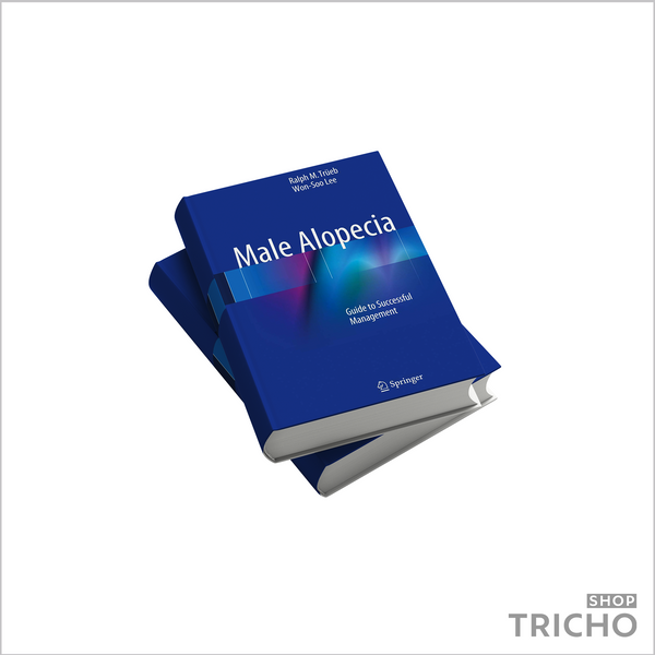 Чоловіча алопеція &ndash; посібник з ефективного лікування. Male Alopecia: Guide to Successful Management 5009 фото