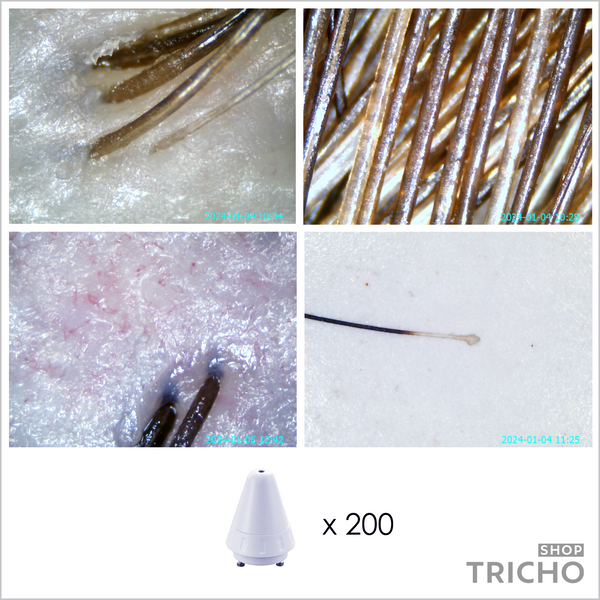 Трихоскоп для діагностики волосся та шкіри голови із програмою, 5 лінз:  х1, х50, х50 UV, х200, х800 1019 фото