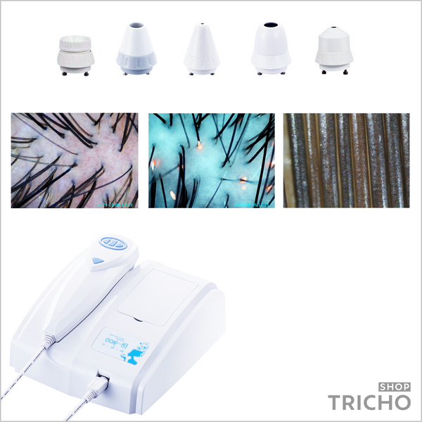 Трихоскоп USB для ПК і ноутбука Windows з програмою TrichoTech, 5 лінз 1019 фото
