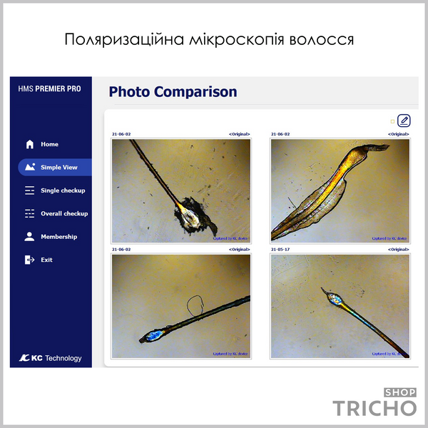 Трихоскоп с АІ для ПК / ноутбука, КС Hair Polarizer, комплектация "Expert" 1010 фото