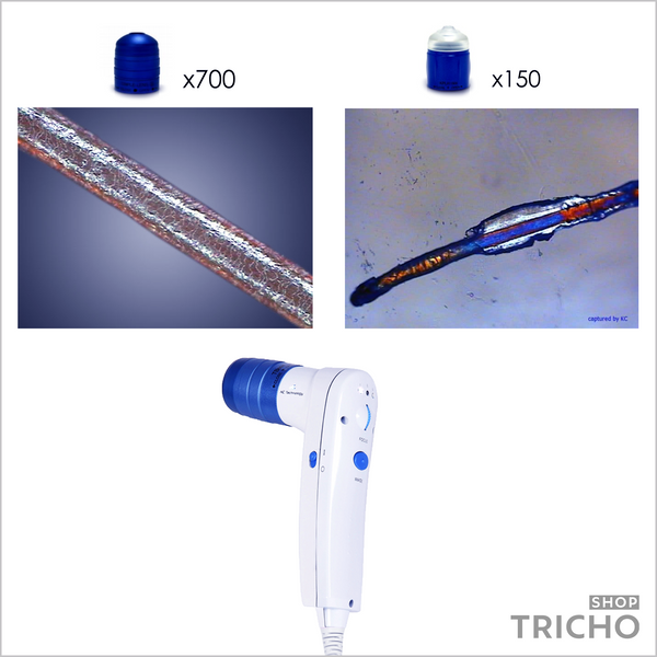 Трихоскоп с АІ для ПК / ноутбука, КС Hair Polarizer, комплектация "Expert" 1010 фото