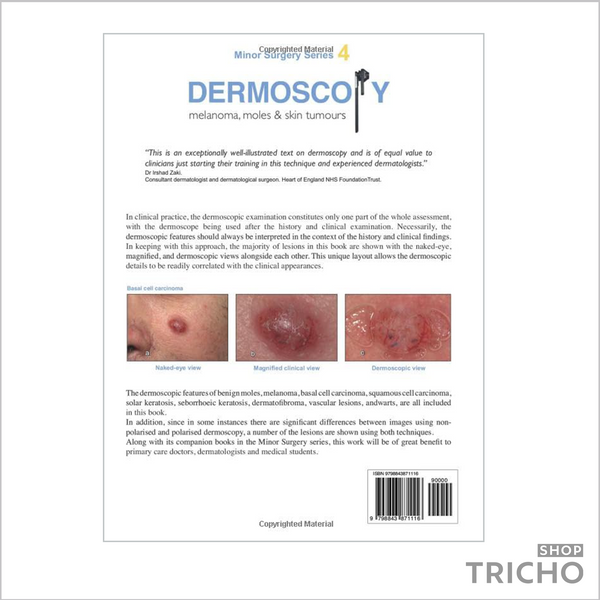 Dermoscopy: A Diagnostic Atlas, Дерматоскопия: диагностический атлас 5010 фото