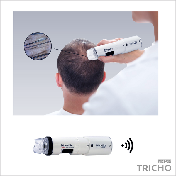 Трихоскоп USB + Wi-Fi, Dino-lite, модель MEDLW4HM 1006 фото